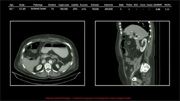 137 Years of Medical Malpractice Part 6 of 9 | Free Radiology CME