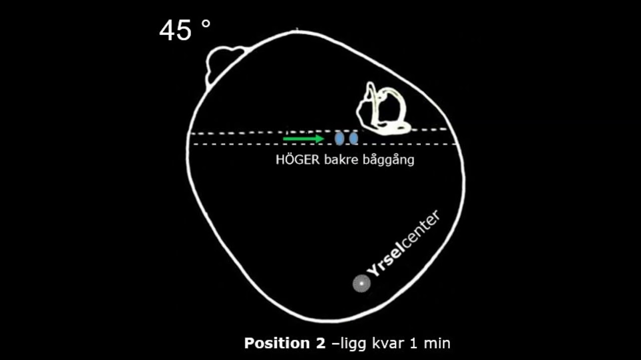 Epleys manover hoeger Yrselcenter Stockholm dr Christian Geisler