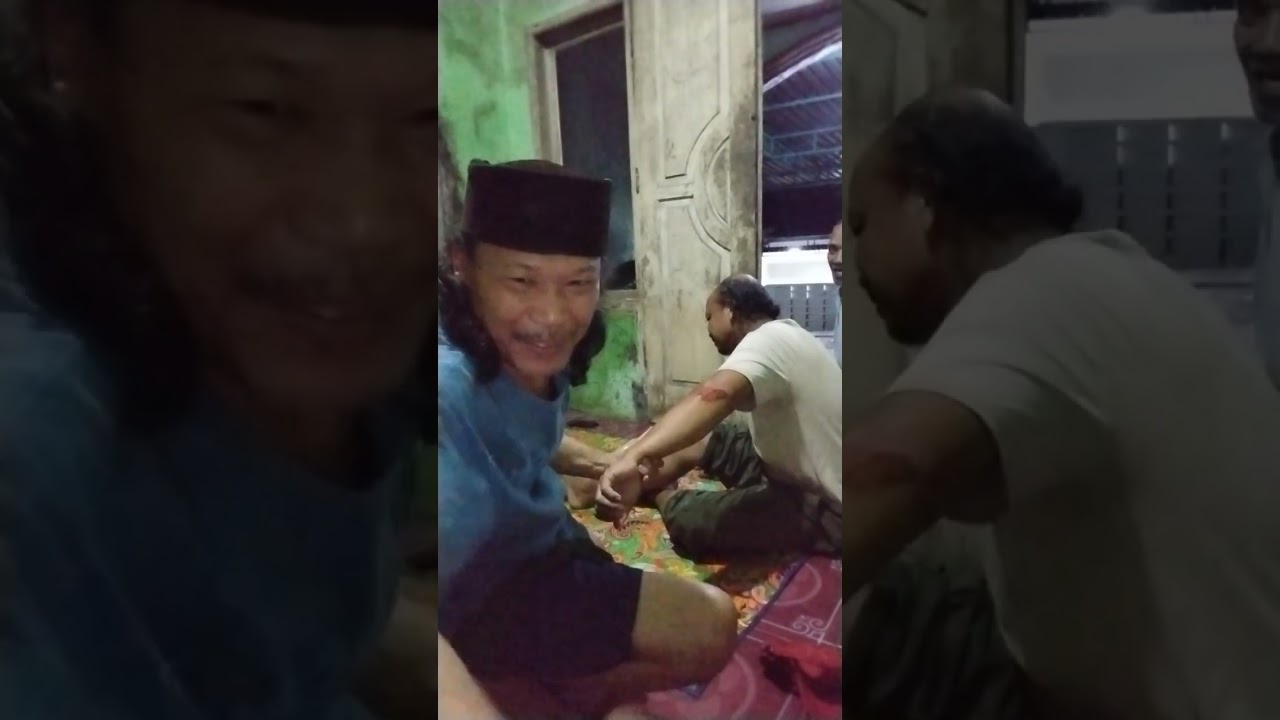 Jatoh dari motor bahu lengan  kaki