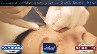 Making 70 Look 20 With Botox Injections by Dr Lebowitz Long Island Plastic Surgery Huntington Ny