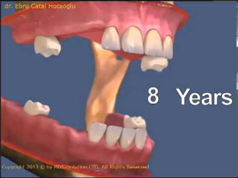 Video: Yaşla dişlər tökülür?
