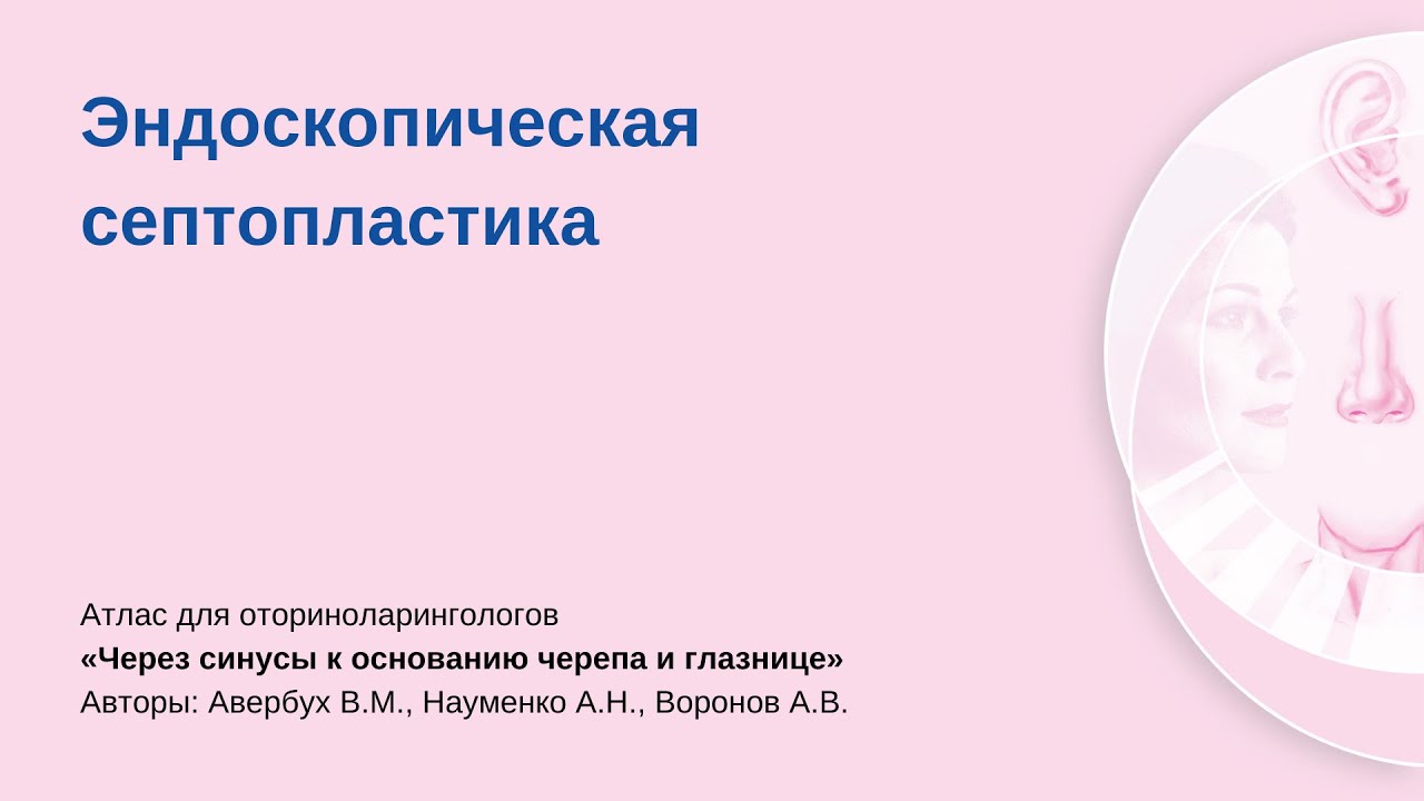 Эндоскопическая септопластика. Операцию проводит Владимир Михайлович Авербух.
