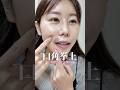 整形で長年のコンプレックスを解消してきた【口角挙上のダウンタイムまとめ】