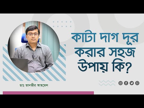 কাটা দাগ দূর করার সহজ উপায় কি ? What is the easiest way to remove cut marks? (4K)