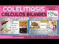 CÁLCULOS BILIARES (FISIOPATOLOGÍA PARTE 2) | GuiaMed