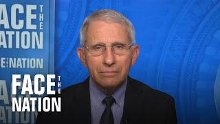 Fauci says CDC's updated mask guidance is \\