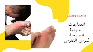 العلاجات المنزلية | الطبيعية| لمرض النقرس | How to avoid gout naturally