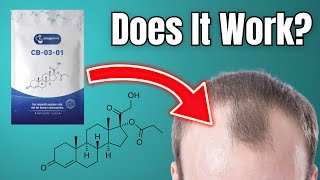 CB-03-01 (aka Breezula, Clascoterone): A Topical Androgen Receptor Inhibitor