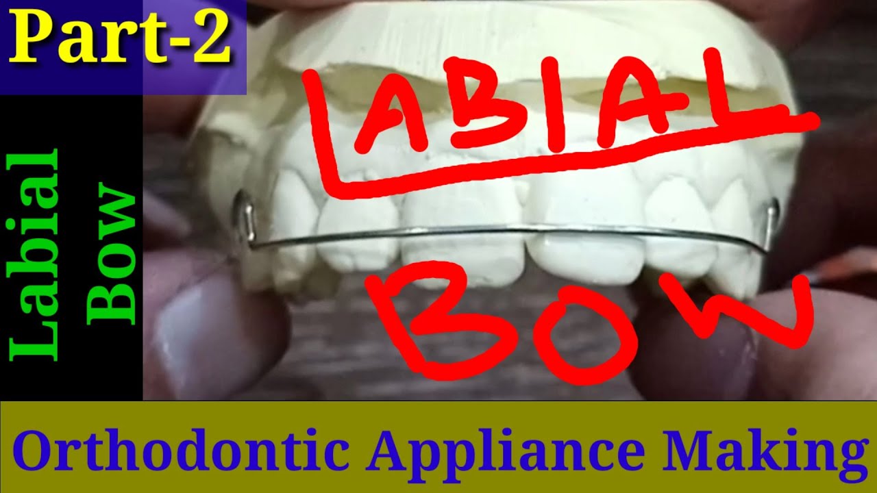 Orthodontic appliance part2 How do you make a Labial Bow How do