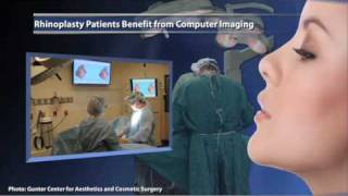 Famous Rhinoplasty Patients Benefit From Computer Imaging Net Worth
