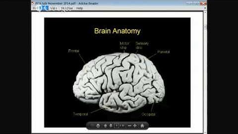 07.11.204 PCA support group meeting: Using imaging and genetics to understand PCA + update