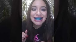 Myo Braces!!!!🤔🤔 $12