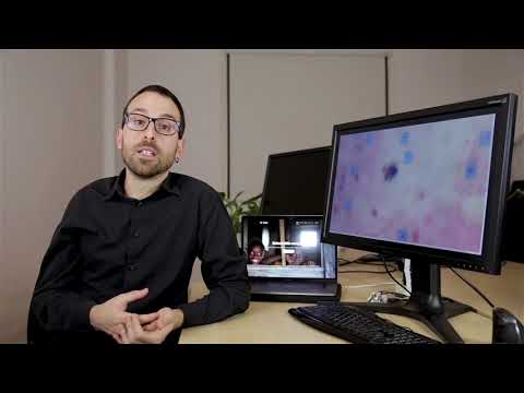 Ai Scope | Fighting Malaria with Machine Learning and Neural Networks