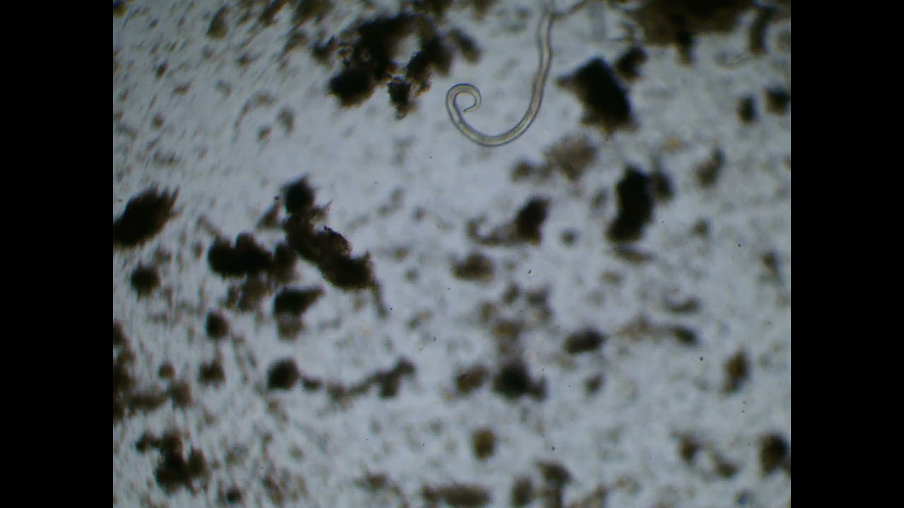 Nematode: Johnson Su Bioreactor - Station 4