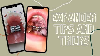 Expander Tips and Tricks #shorts Wealth