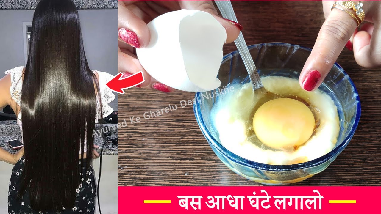 दही में ये मिलाकर लगालो Curd and Egg for Shiny Strong Hair Growth | Ayurved ke Gharelu Desi Nuskhe