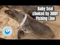 Seal Baby Choked By 300 Ft Of Fishing Line