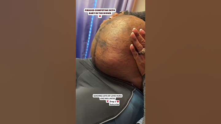 Fibroid competing with baby in momma womb #shorts #shortsfeed #short #pregnancyvlogs #motherhood