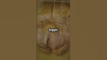 Scientists Discover Shocking Link Between Brain Waves and Aging - You Won