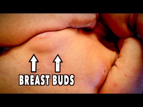 BABY BOY with BREAST BUDS | Dr. Paul