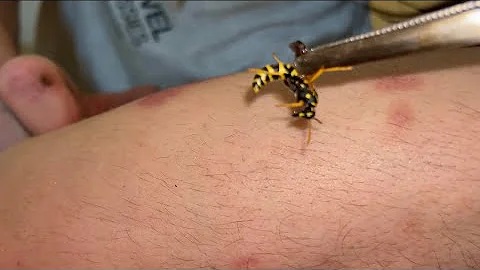 Wasp vs hornet vs bee sting 😨