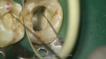 Jaká jsou kalová čerpadla?