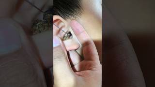 Ear wax remover #earwax #youtubeshorts #asmr #earcleaning #earwaxremoval #youtubeshort
