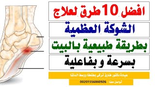 افضل 10 طرق طبيعية لعلاج الشوكة العظمية بالقدم بسرعة وبفاعلية بالمنزل نهائيا