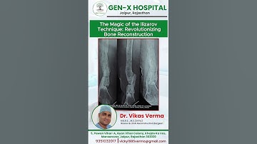 The Magic of the Ilizarov Technique: Revolutionizing  Bone Reconstruction
