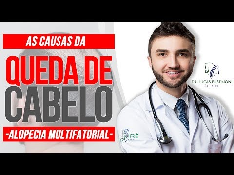 💥 CAUSAS da ALOPECIA MULTIFATORIAL | Queda de Cabelo | Dr Lucas Fustinoni