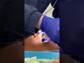 Tooth extraction part 1 |@JulietRasco