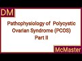Pathophysiology of polycystic ovarian syndrome