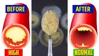 This Mixture Will Unclog Arteries Naturally and Control High Blood Pressure | Healthcare Plus