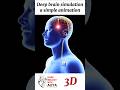 Deep brain simulation- a simple animation | #3d #short | learn Biology with Aliya