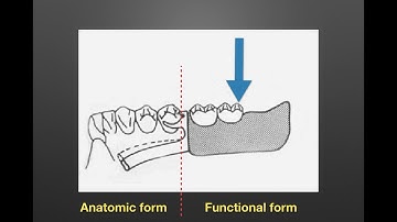 9.  RPD impression and Altered cast technique