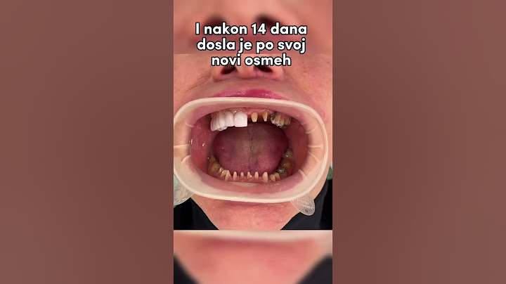 Da li biste vi smeli da obrusite zube ovako???