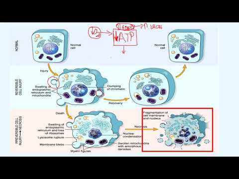 Vídeo: Diferencia Entre Lesión Celular Reversible E Irreversible