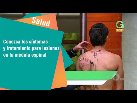 Vídeo: Accidente Cerebrovascular Espinal: Síntomas, Recuperación, Causas, Tratamiento Y Más