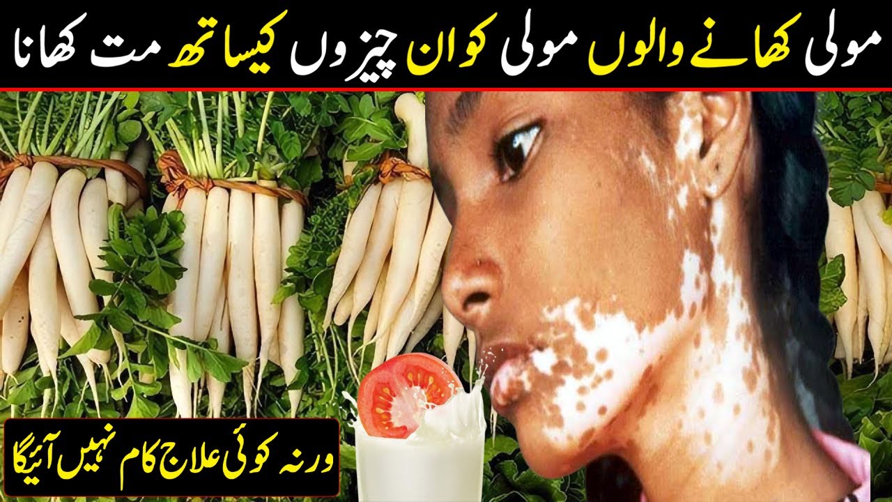 Mooli Istemal Karne Ke Fawaid Aur Nuqsanat | Health benefits of Radish