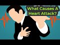 What Causes A Heart Attack?#shorts#biology
