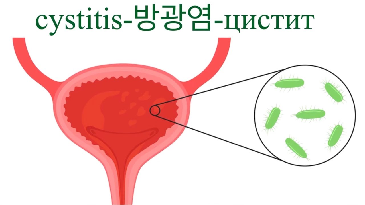 Цистит яагаад дахидаг вэ?