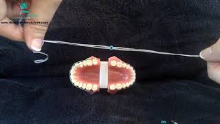 Digital Education- Orthodontic Spacers and Separators https://www.straightsmilesolutions.com/