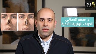 أسباب انحراف الوتيرة الأنفية وطريقة علاجها