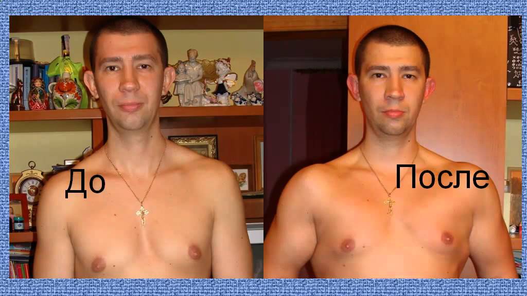 можно ли поправиться от уколов