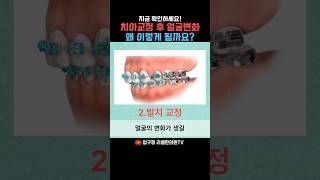 치아교정 얼굴변화, 원인과 대처법 알려드립니다! #치아교정얼굴변화 #치아교정