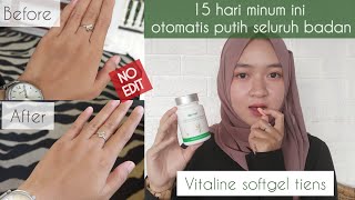 Review Lengkap Vitaline Softgel Tiens | 2 Minggu Otomatis Seluruh Badan Putih screenshot 1