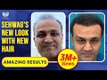 The truth about Virender Sehwag’s Hair Transplant | Hair Transplant In India, MedLinks