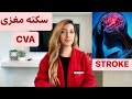 صفر تا صد سکته مغزی Stroke CVA علت انواع درمان صفر تا صد سکته مغزی Stroke CVA علت انواع درمان