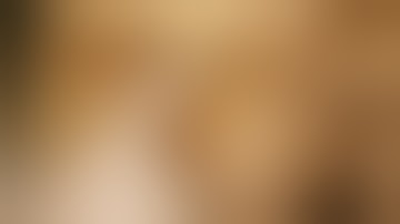 TEMPORAL FASCIA MUSCLE and FOSSA Boundaries Contents with Clinical Aspects – Sanjoy Sanyal