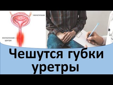 Чешутся губки уретры